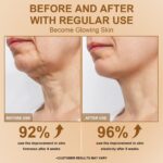 Neck Firming Cream for Crepey Skin, Firm Lift Neck Cream with Roller Design for Skin Deep Moisturizing, Tightening, and Lifting, Suitable for All Ages Women and Men, 4.20 FL OZ, White - Image 6