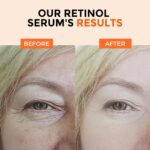 Retinol Serum for Face 2.5%, B5 Herbal Resurfacing Retinol with Vitamin C, Vitamin E, Hyaluronic Acid, Anti-Aging, Wrinkle Smoothing, Dark Spot Corrector, Brighten Dullness 2 Packs - Image 6