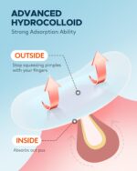 Acne Pimple Patch (180 Counts 4 Sizes), FSA Eligible Invisible Hydrocolloid Acne Patch with Tea Tree Oil & Calendula Oil, Acne Spot Patch Zit Patches for Face - Image 4