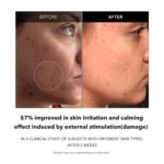 APRILSKIN Carrotene Clarifying Facial Serum | Vegan, Non-comedogenic | Blemish Clear, Dark Spot Corrector | Korea Skincare | Oily Skin, Sensitive Skin, Bumpy Skin | 1.25 fl.oz - Image 5