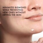 Vichy Normaderm S.O.S Acne Rescue Spot Corrector, Acne Spot Treatment for Face with 10% Sulfur, Niacinamide & Glycolic Acid, Suitable for Sensitive Skin - Image 5