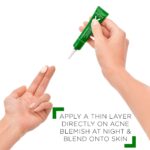 Vichy Normaderm S.O.S Acne Rescue Spot Corrector, Acne Spot Treatment for Face with 10% Sulfur, Niacinamide & Glycolic Acid, Suitable for Sensitive Skin - Image 6