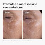 The Ordinary Glycolic Acid 7% Exfoliating Toner, Brightening and Smoothing Daily Toner for More Even-Looking Skin Tone - Image 3